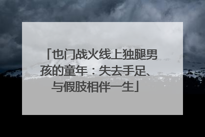也门战火线上独腿男孩的童年：失去手足、与假肢相伴一生